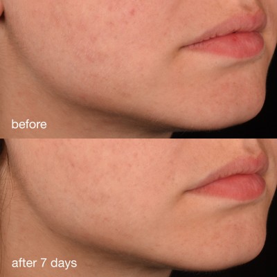 Dermalogica Pro-Collagen Banking Serum - Антиоксидантна сироватка з колагеном, 30мл