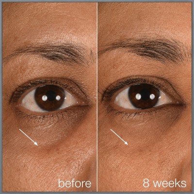 Dermalogica Smart Eye Density Serum - Сироватка-альтернатива філерам для зони навколо очей, 15 мл Dermalogica Smart Eye Density Serum - Сироватка-альтернатива філерам для зони навколо очей, 15 мл