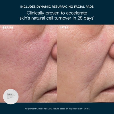 ELEMIS Kit: Glow Bright Resurfacing Trio - Тріо для сяйва шкіри ELEMIS Kit: Glow Bright Resurfacing Trio - Тріо для сяйва шкіри