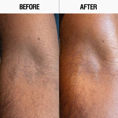 Grown Alchemist Resurfacing Targeted Body Lotion - Лосьйон для регенерації та вирівнювання мікрорельєфу тіла, 300 мл Grown Alchemist Resurfacing Targeted Body Lotion - Лосьйон для регенерації та вирівнювання мікрорельєфу тіла, 300 мл