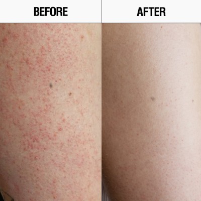 Grown Alchemist Resurfacing Targeted Body Cleanser - Гель глибокого очищення для  шовковистої гладкості шкіри, 300 мл